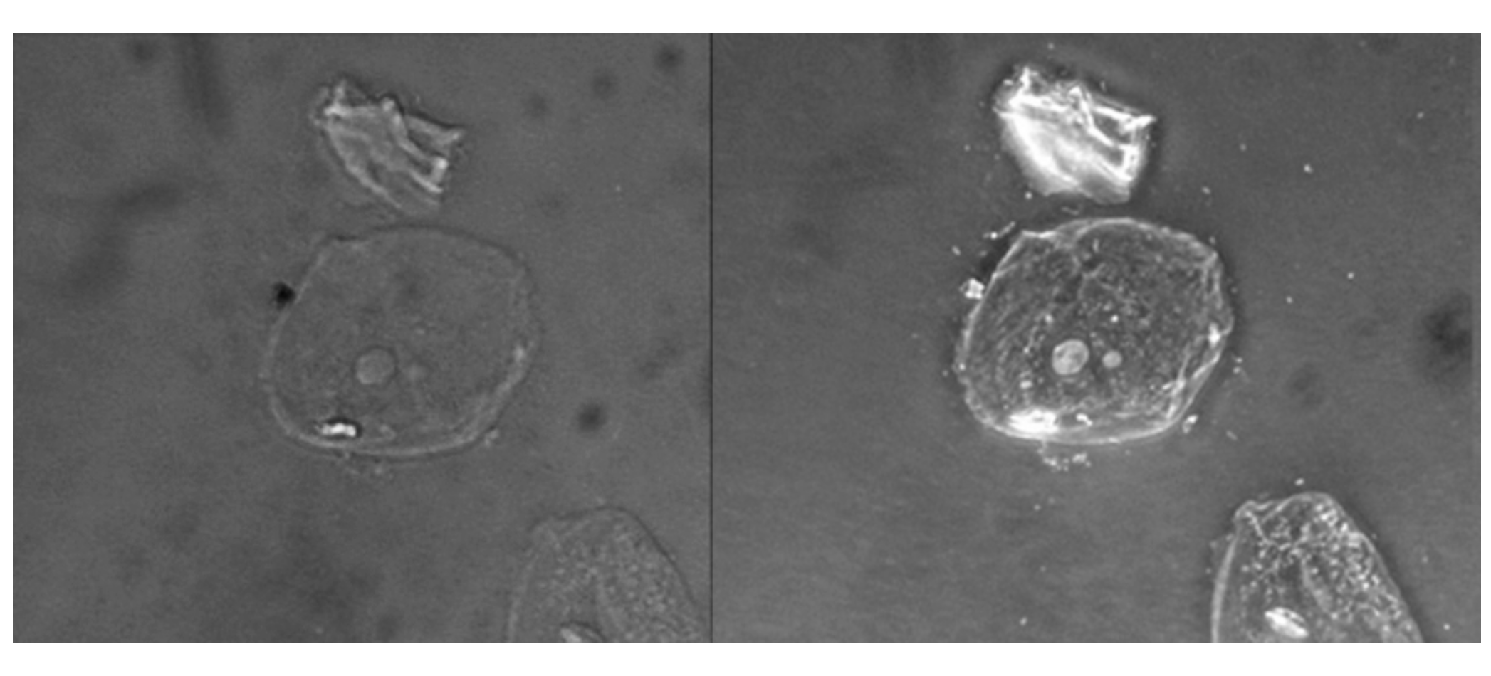 Two micrographs of a cell on a dark background are shown. In the brightfield image the cell is a faint circle with a small grey circle in the center. In the phase-contrast image the cell is a bright circle with a bright circle in the center.