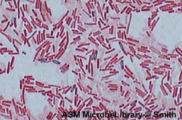 A table shows light microscope types. These use visible or ultraviolet light to produce an image. Magnification: up to about 1000x. Brightfield microscopes are commonly used in a wide variety of laboratory applications as the standard microscope and produce an image on a bright background. The sample image of Bacillus species shows red rods on a clear background; small green dots in the red cells indicate endospores.