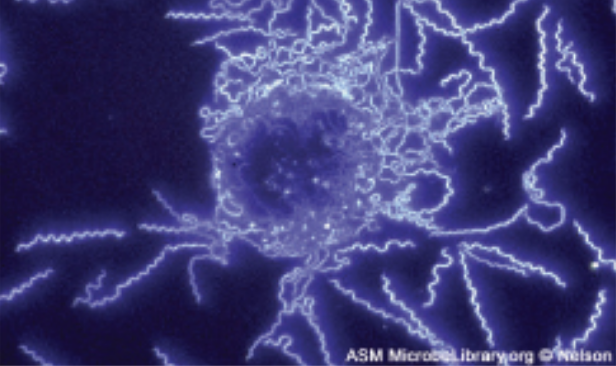 Darkfield microscopes increase contrast without staining by producing a bright image on a dark background. These are especially useful for viewing live specimens. The sample image (Borrelia burgdorferi) shows bright spirals on a dark background.