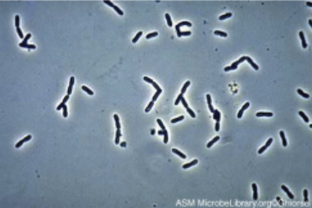 Phase contrast microscopes use refraction and interference caused by structures in the specimen to create high-contrast, high-resolution images without staining, making it useful for viewing live specimens and structures such as endospores and organelles. The sample image (Pseudomonas sp.) shows dark rods with a bright halo. Differential interference contrast (DIC) uses interference patterns to enhance contrast between different features of a specimen to produce high-contrast images of living organisms with a three-dimensional appearance, making it especially useful in distinguishing structures within live, unstained specimens. Images viewed reveal detailed structures within cells.