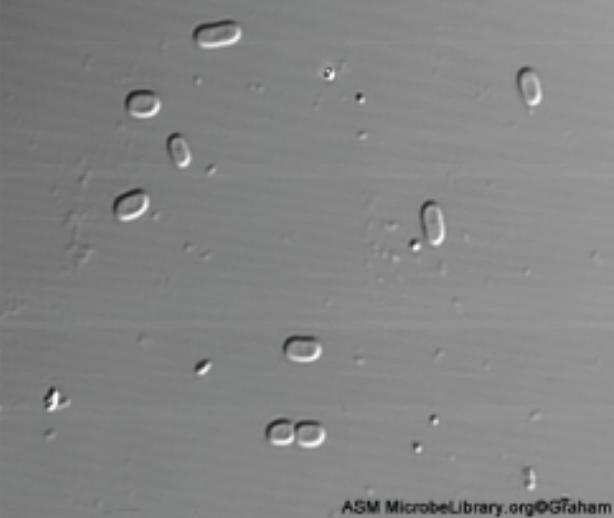 The sample image (Escherichia coli 0157:H7) shows small three-dimensional ovals. Fluorescence uses fluorescent stains to produce an image. Fluorescent microscopes can be used to identify pathogens, to find particular species, to distinguish living from dead, or to find location of particular molecules within a cell; also used for immunofluorescence.