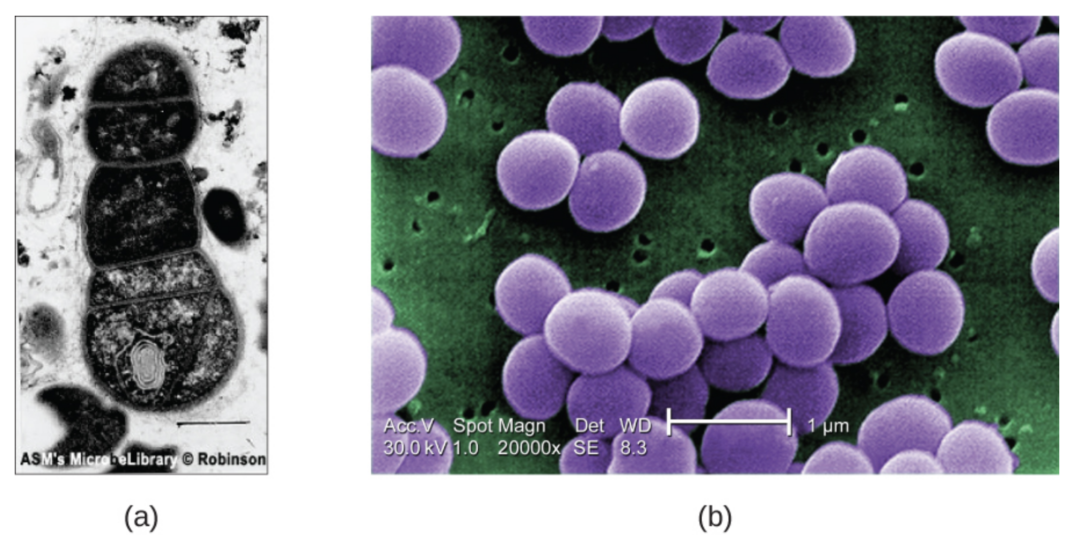 Figure a shows A TEM micrograph with a clear background and a dark cell in the center. A double line outlines the edge of the cell and webs of material inside the cell are visible. Figure b shows an SEM micrograph that has large purple clusters on a green background with small holes. The three-dimensional shape of the purple clusters is apparent.