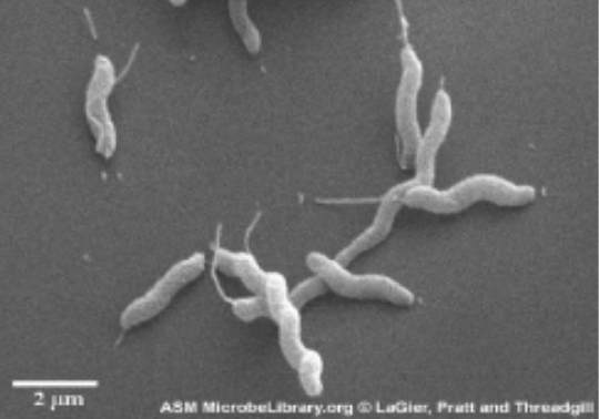 Scanning electron microscopes (SEM) use electron beams to visualize surfaces; useful to observe the three-dimensional surface details of specimens. The sample image (<i>Campylobactor jejuni</i>) shows thick three-dimensional spirals.