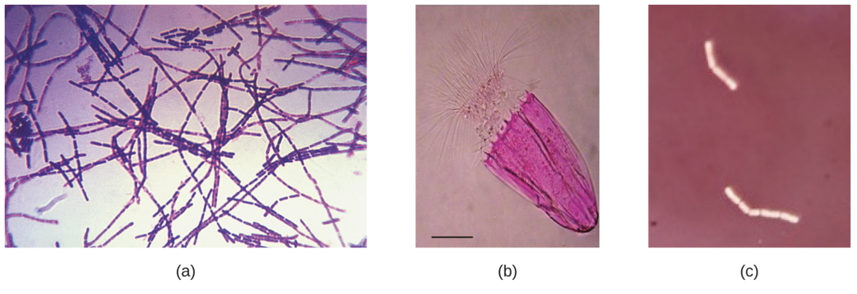 Micrograph A shows many chains of thin purple rods. Micrograph B shows a bright pink half-oval with a tufted top. Micrograph C shows two short, white, unstained chains of rods against a darker background.