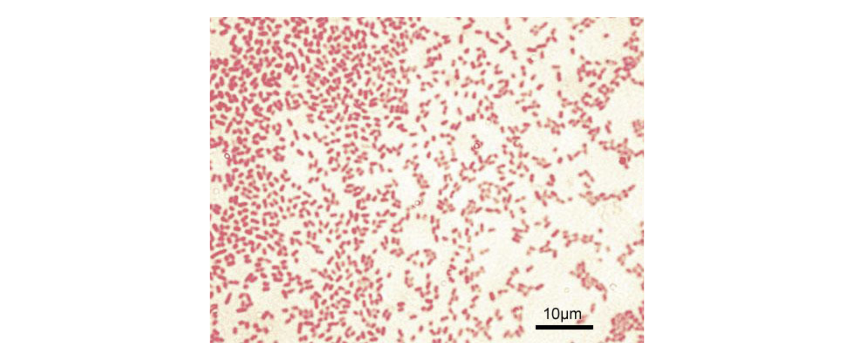 A micrograph shows many small, light pink rod-shaped bacteria.