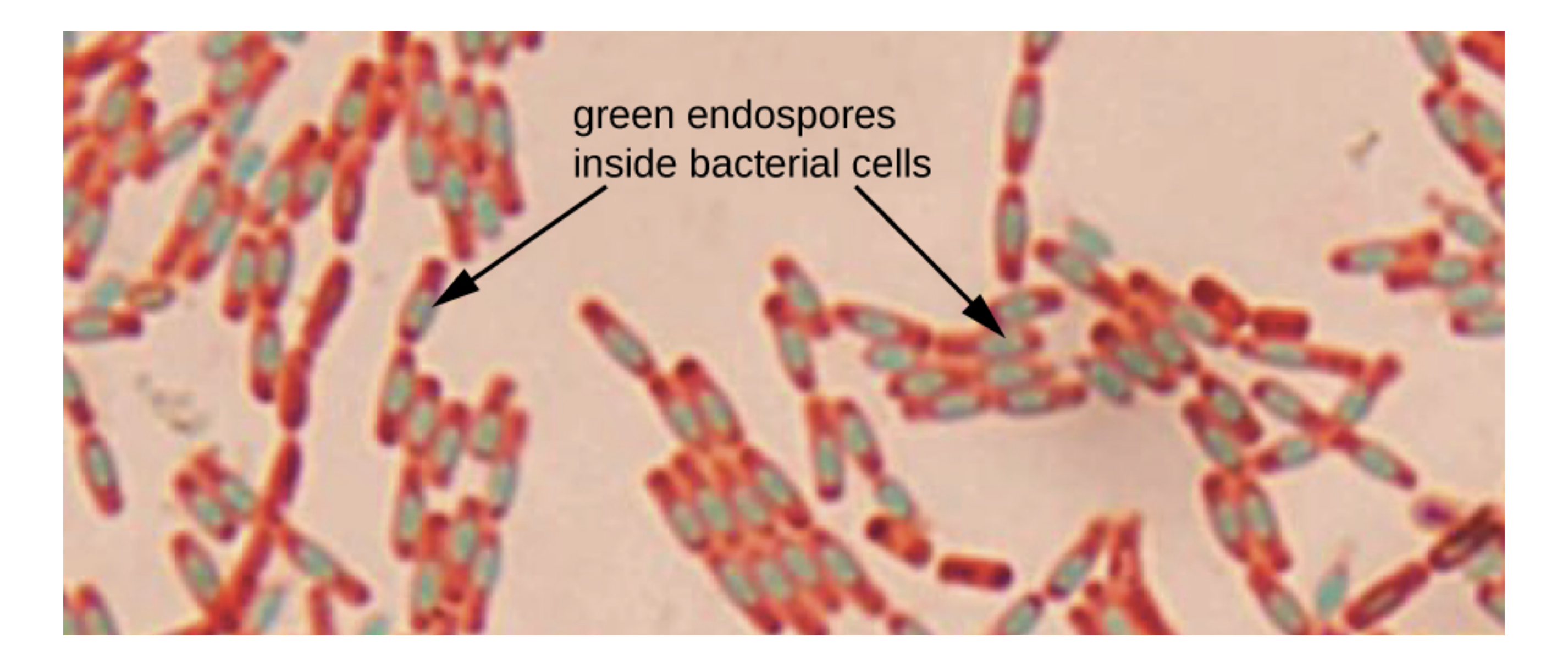 A micrograph shows chains of red rods. Each red rod contains a green oval. An arrow pointing to the green ovals with text stating “green endospore inside bacterial cells”.