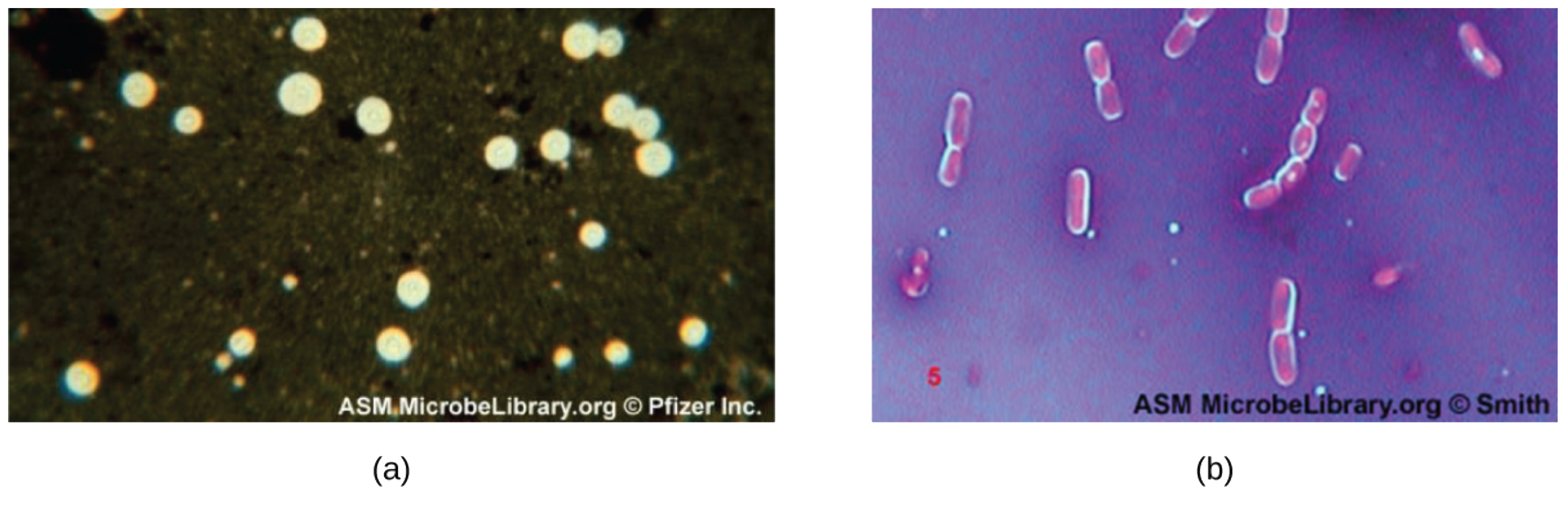 Micrograph (A) shows clear spheres on a black background. Micrograph (B) shows pinkish rods. Most of the rods have a clear halo along their borders. The background is a dark pattern of blue and purple.