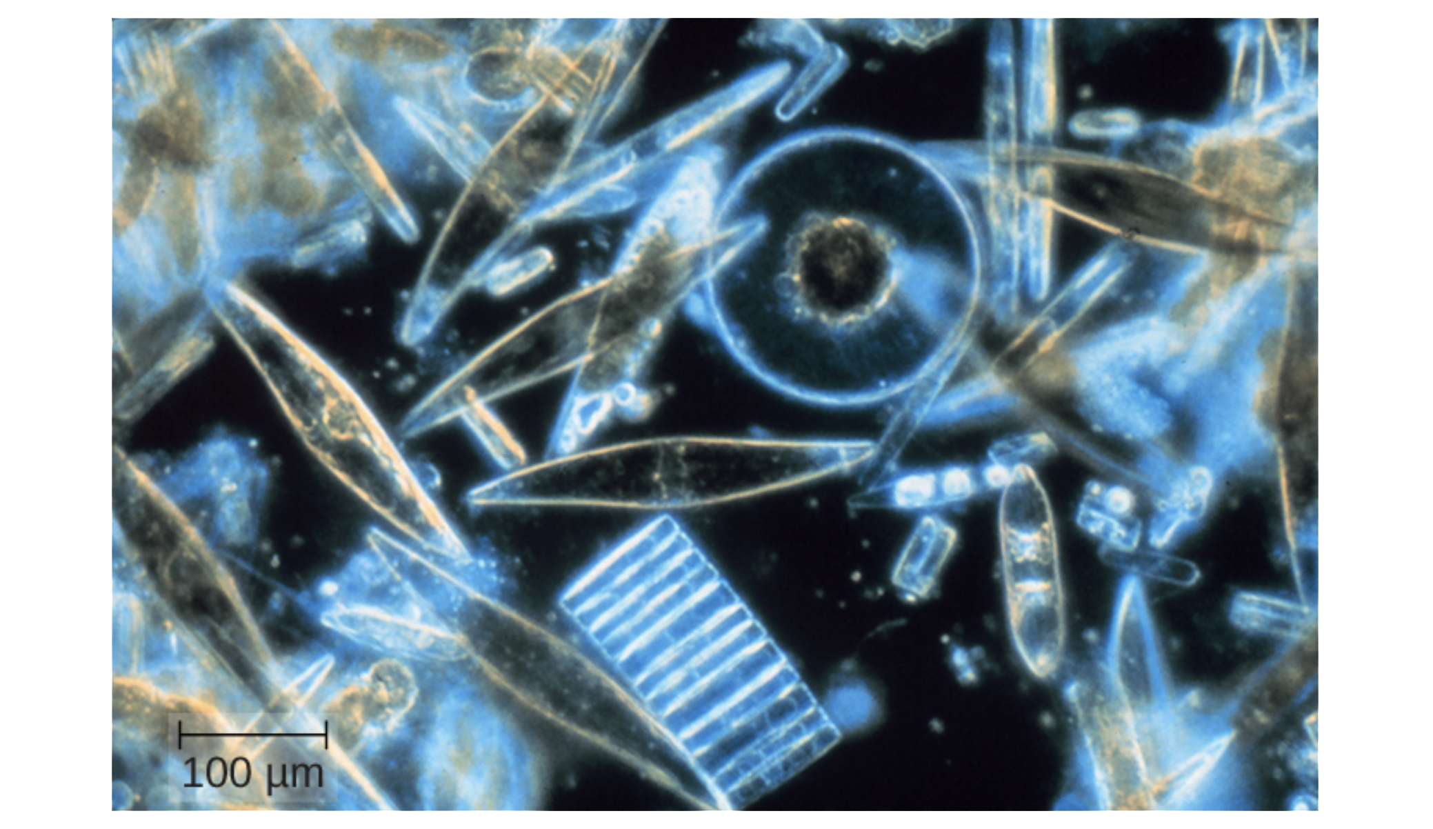 A light micrograph with a black background and glowing cells. The cells have many different shapes ranging from circular to stacks of rectangles to almond shaped. A scale bar indicates how much space 100 microns takes up in this figure.