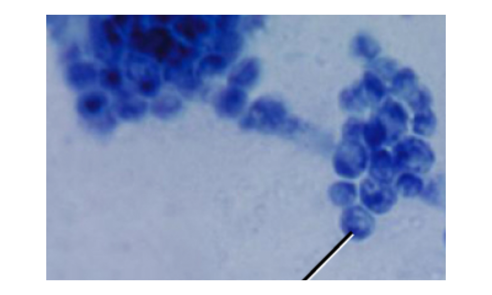 A light micrograph with a clear background and blue cells. A long row of cells forms a central strand. Attached to this are clusters of many spherical cells. Each cell is approximately 5 µm in size and contains a nucleus.