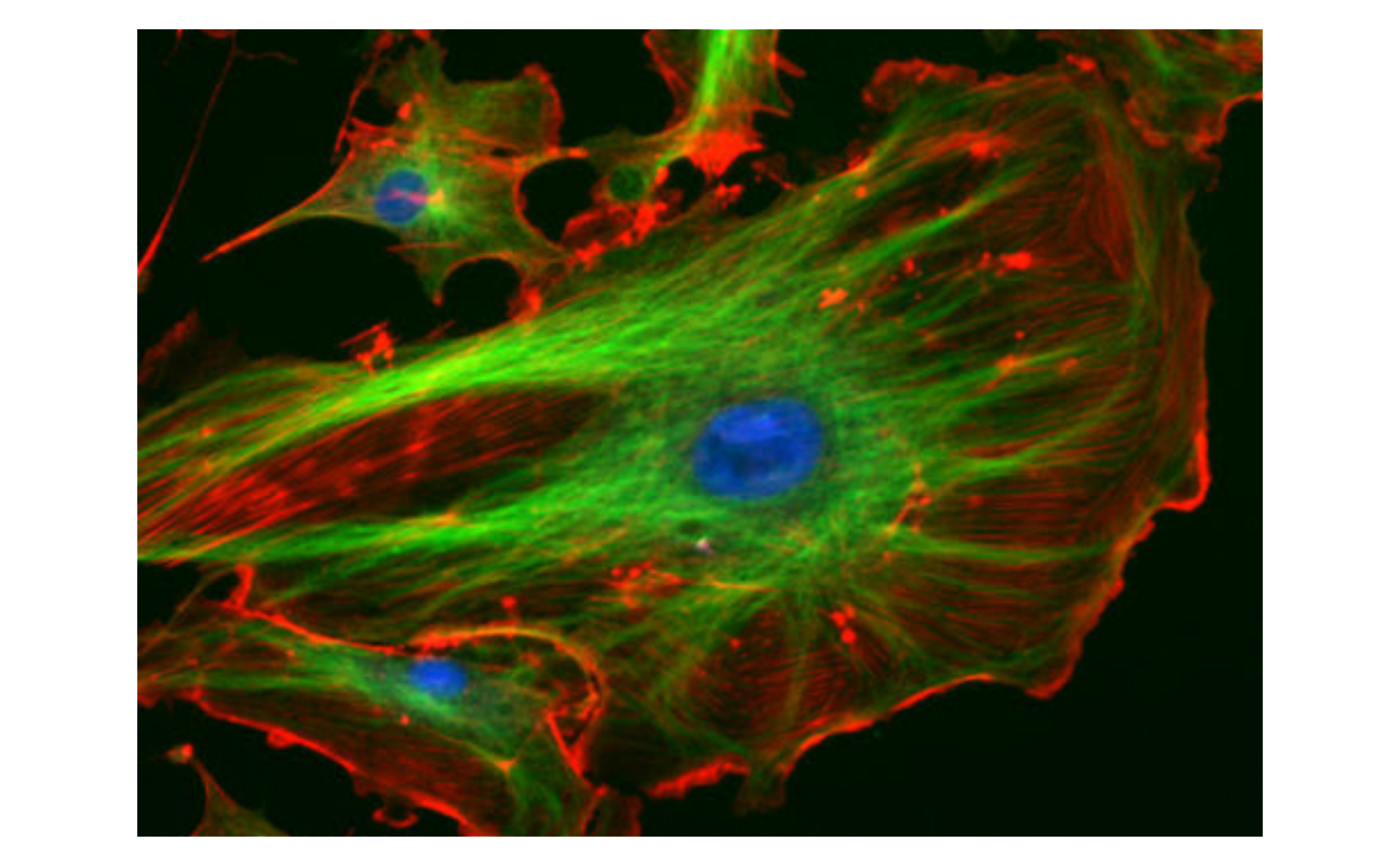 An image shows a large cell in the foreground and other cells further in the background. Each cell has an irregular shape with a large blue circle in the center. Green lines surround the blue circle and span out towards the edges of the cell. The rest of the cell is red with a bright red edge. The background of the image is black.