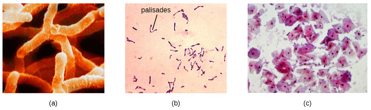 (a) A micrograph shows branched cells. (b) A micrograph shows cells arranged in a “V”-shape with one “V”-shaped are labeled palisades. (c) A micrograph of corn-flake shaped cells that each have a distinct, round nucleus. An arrow points to much smaller cells outside of these. The smaller cells do not have nuclei.