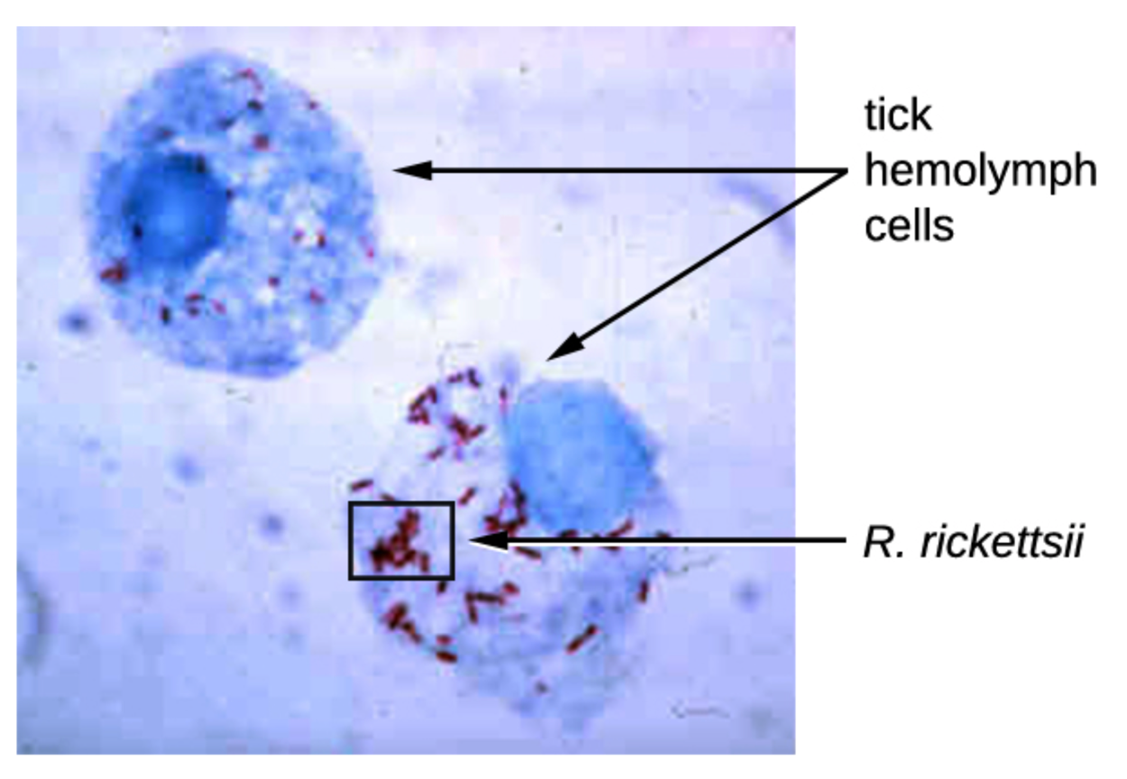 A micrograph shows two round blue tick hemolymph cells. Inside of each of these cells, there are multiple small, red, rod-shaped bacterial cells labeled R. rickettsii.