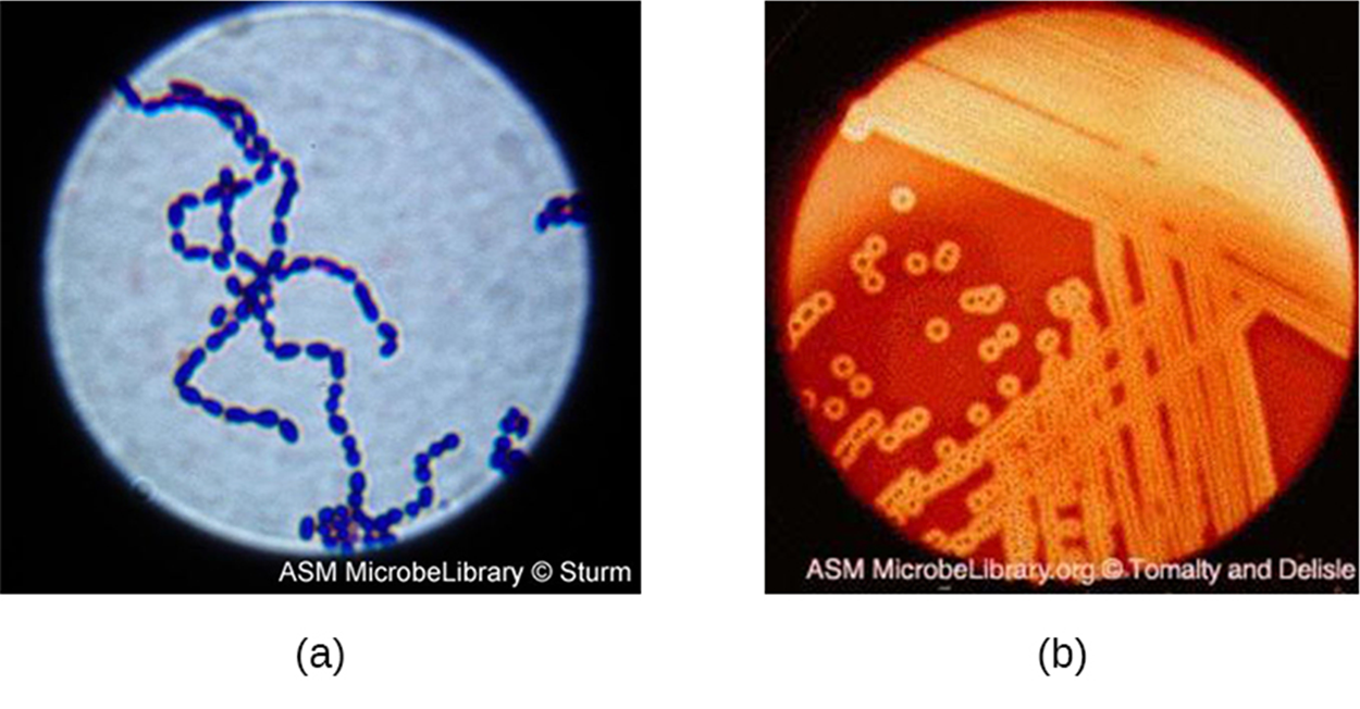 (a) A micrograph of spherical cells in a chain. (b) A photograph of colonies on agar. The agar is red, and there is a clearing around each colony.