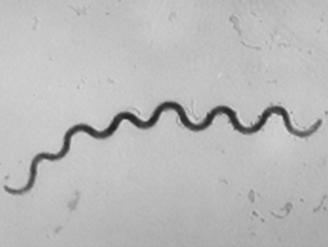 Image of spirochete shape.