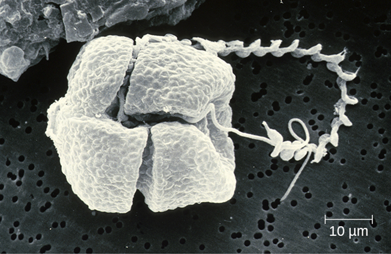 A micrograph shows a relatively square structure with openings across its surface dividing it into a larger part on the left and two smaller parts on the right. A thready structure extends from the right side and loops up and then down to meet the top center of the square.