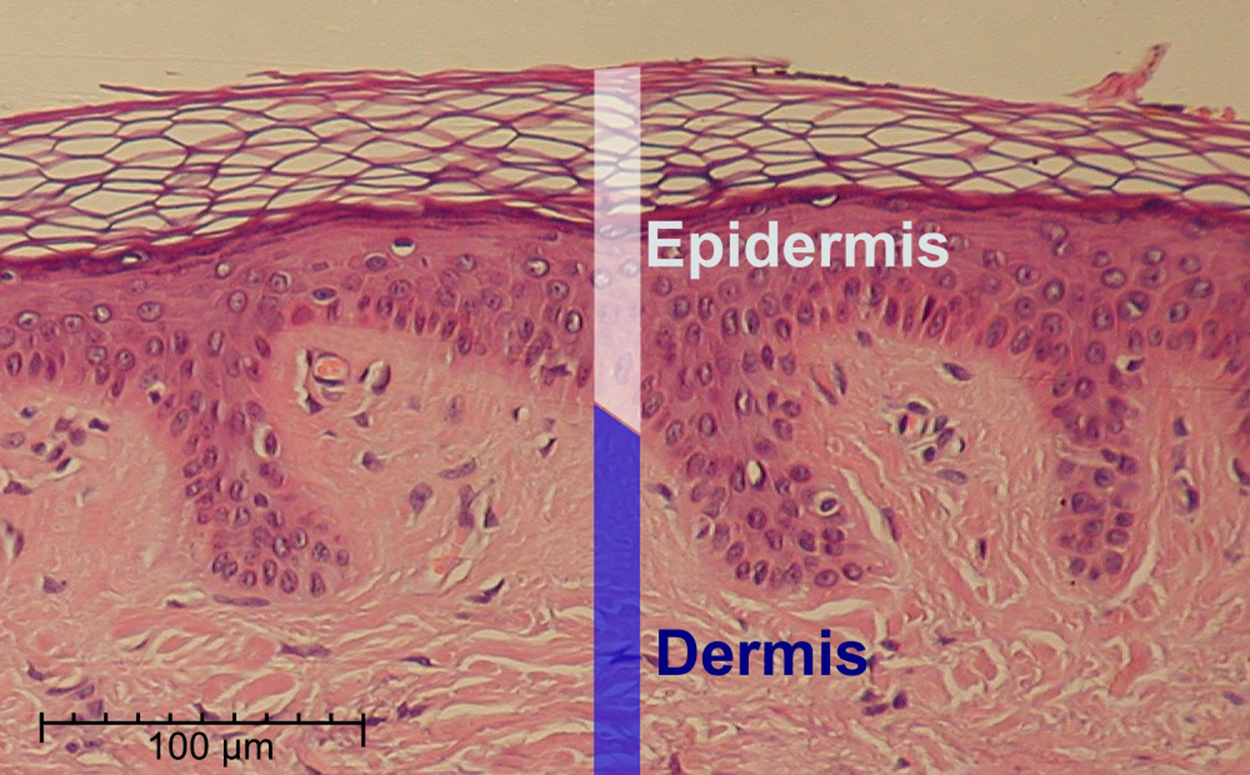 This is a hematoxylin and eosin stained slide at 10x of normal epidermis.