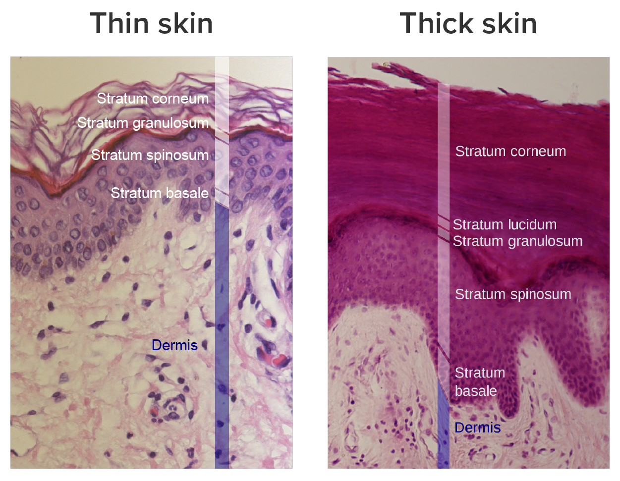 Part A is a micrograph showing a cross-section of thin skin. The topmost layer is a thin, translucent layer with irregular texture and areas where cells are sloughing off. The deepest layer is dark purple and extends into the third layer with finger-like projections. The third light purple layer contains thin bands of fibers and small, dark cells. The fourth, and deepest layer, is darker than the third layer but is still light purple. It contains thick fiber bands that are loosely packed. Part B is a magnified view of the epidermis of thick skin. It shows the topmost layer is five times thicker than the topmost layer of thin skin. The topmost layer of thick skin is also denser and less translucent than the topmost layer of thin skin.