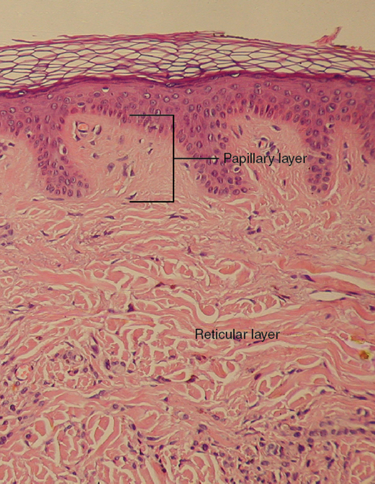 This micrograph shows layers of skin in a cross-section. The papillary layer of the dermis extends between the downward fingers of the darkly stained epidermis. The papillary layer appears finer than the reticular layer, consisting of smaller, densely-packed fibers. The reticular layer is three times thicker than the papillary layer and contains larger, thicker fibers. The fibers seem more loosely packed than those of the papillary layer, with some separated by empty spaces. Both layers of the dermis contain cells with darkly stained nuclei.