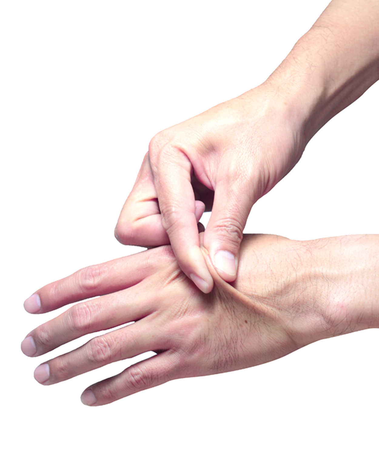 Skin elasticity check. The right hand pull the skin on the back of left hand.