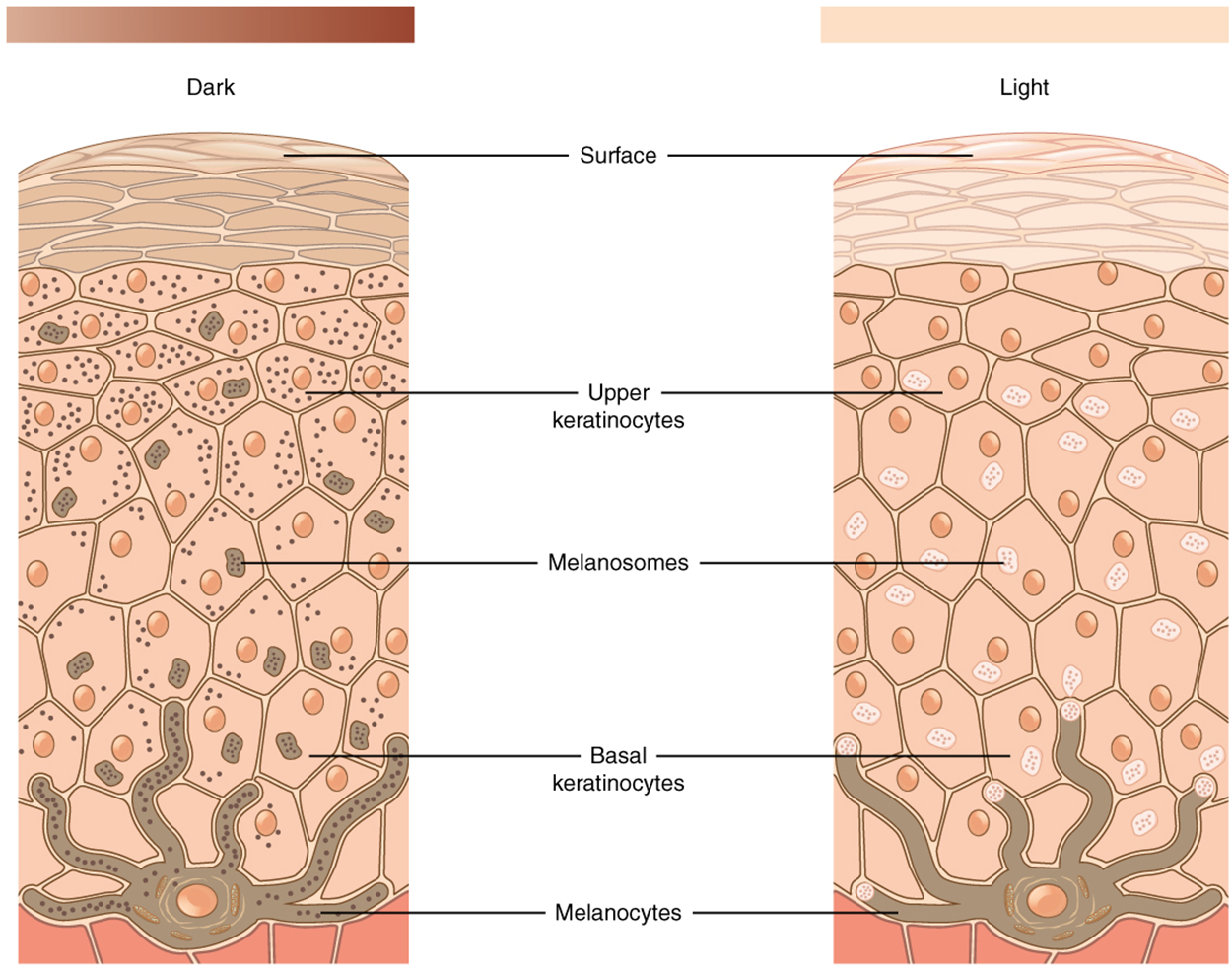 This figure consists of two diagrams side by side. The right diagram shows development of light-colored skin; the left shows development of dark-colored skin. In both, a brown melanocyte sits at the border between the dermis and epidermis. The melanocyte has a large nucleus and six finger-like extensions. These reach between cells of the stratum basalis. Sections of the extensions detach and travel through the skins. These are melanosomes. In the left diagram, both the melanocyte and melanosomes contain melanin particles, shown as dark dots. Melanosomes travel upwards to outer skin layers, releasing melanin. As a result, keratinocytes in the left diagram contain several melanin particles that darken skin color. In light-colored skin, the melanocyte contains no melanin. It still releases melanosomes into upper layers of the skin; however, these melanosomes contain no melanin. Therefore, the skin does not darken and remains light.
