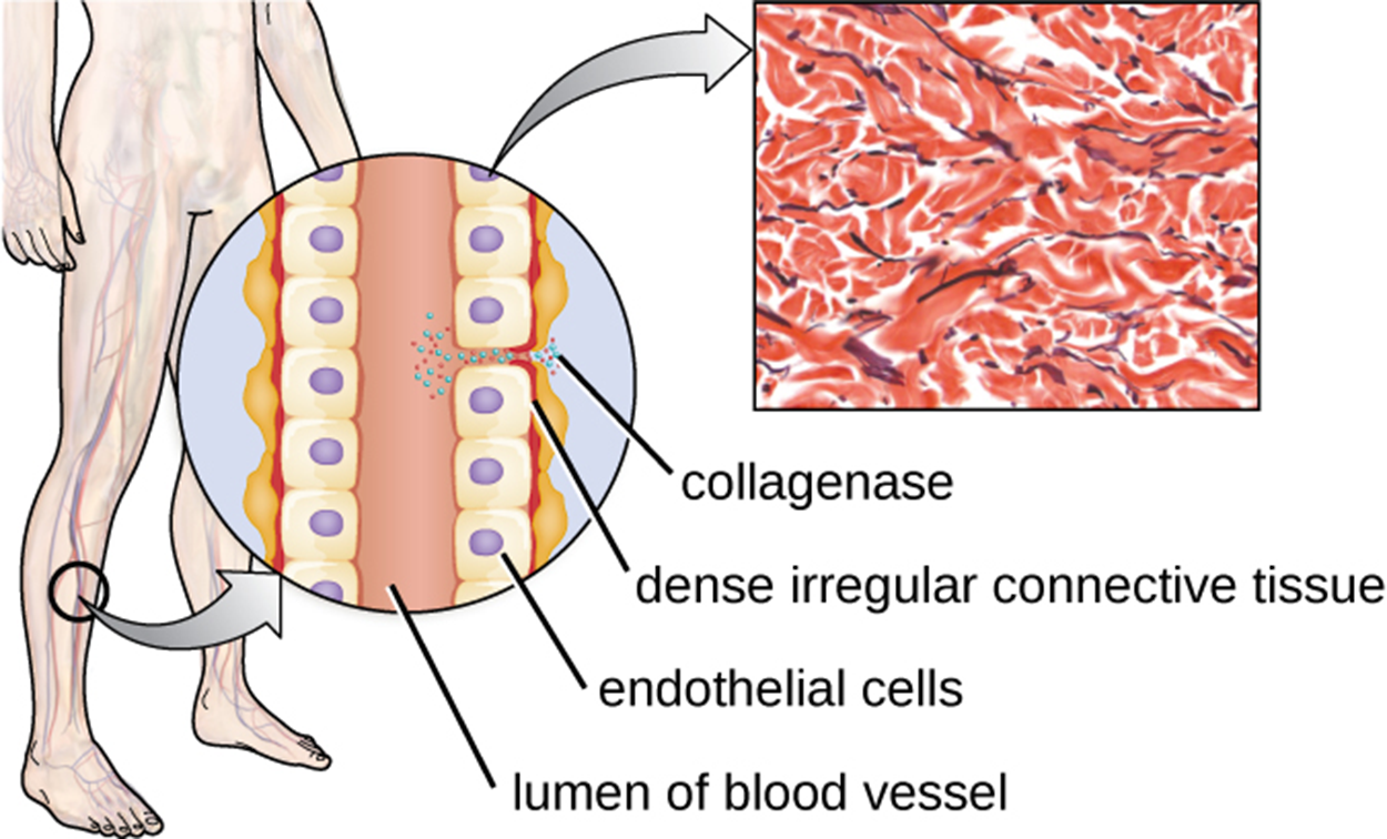 A tube labeled lumen of blood vessels lined by cells labeled endothelial cells. Outside the cells is dense irregular connective tissue. Collagenase is shown as small dots that break up the connections between the cells. A micrograph of the dense connective tissue shows many red lines making a meshwork.