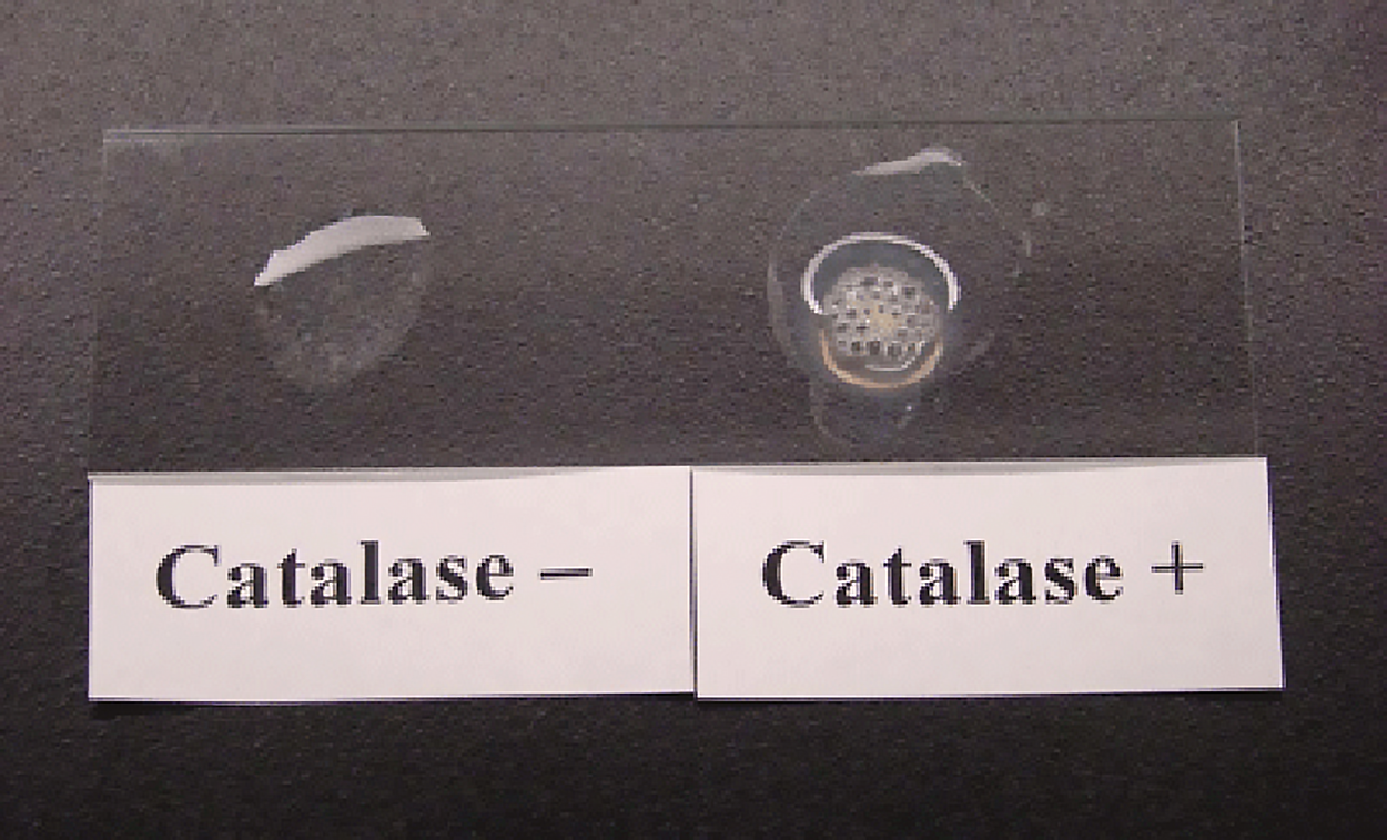 image shows catalase tests with positive and negative results. A positive result is indicated by bubbles from oxygen gas production.