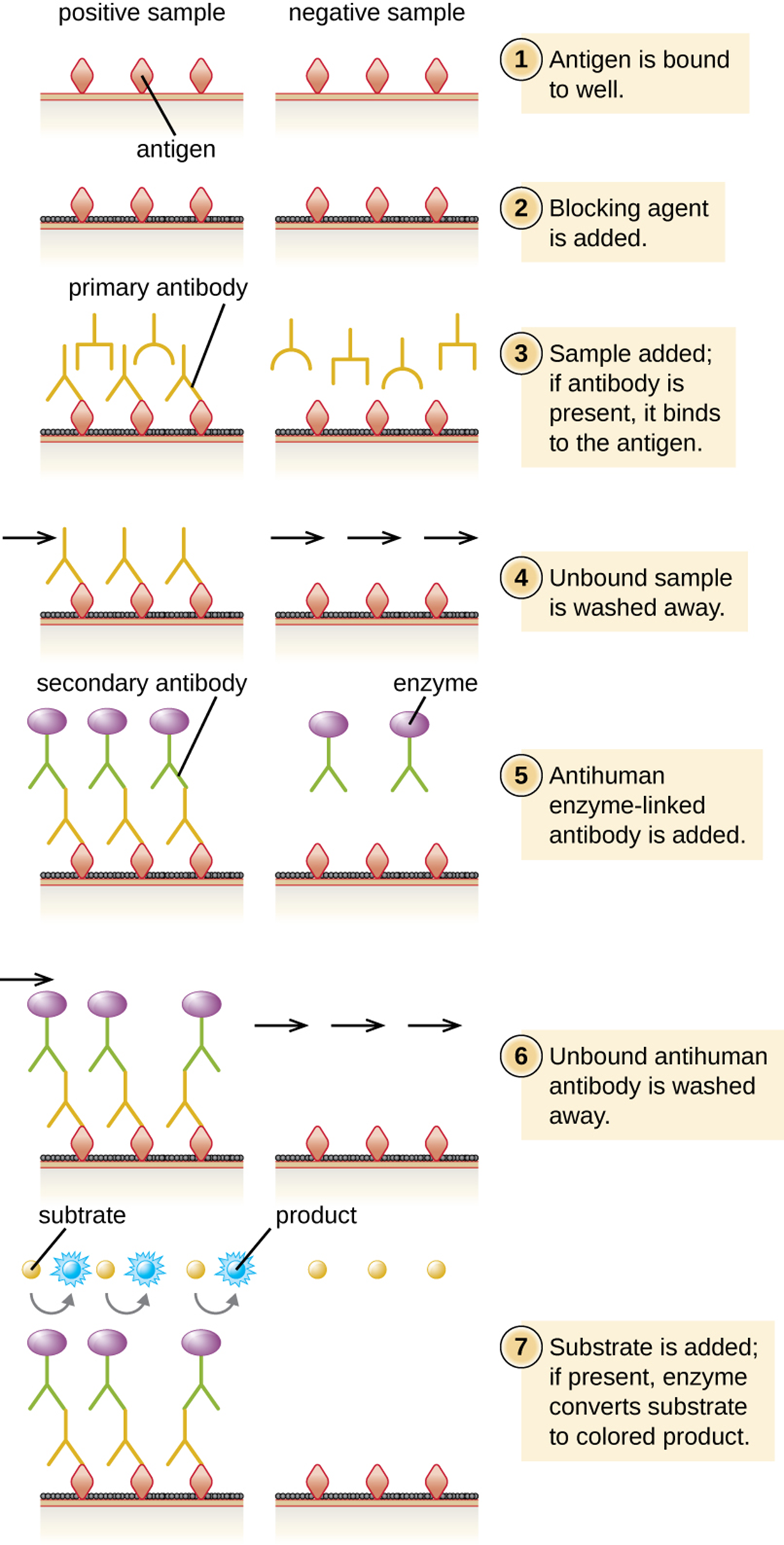 A Diagram of indirect ELISA showing what happens in both a positive and a negative sample. First, the antigens are bound to the well. This is shown as diamonds on the surface of both the positive and negative wells. Next, a blocking agent is added. This is shown as a black covering on the surface between the antigens. Next, the sample is added. If the correct antibody is present it binds to the antigen. This is shown as Ys in both the positive and negative wells. Otherwise, nothing binds to the antigen. Next, any unbound sample is washed away. In the positive well, there is an antibody bound to the antigen, in the negative well, there is nothing bound to the antigen. Next, an anti-human enzyme-linked antibody is added. This is shown as a Ys with a purple circle in both wells. Next, unbound antigen is washed away. In the positive sample, this Y remains bound to the old antibody. In the negative well, it is no longer present. Finally, a substrate is added to both wells. In the positive well, the enzyme changes the substrate to a blue color.