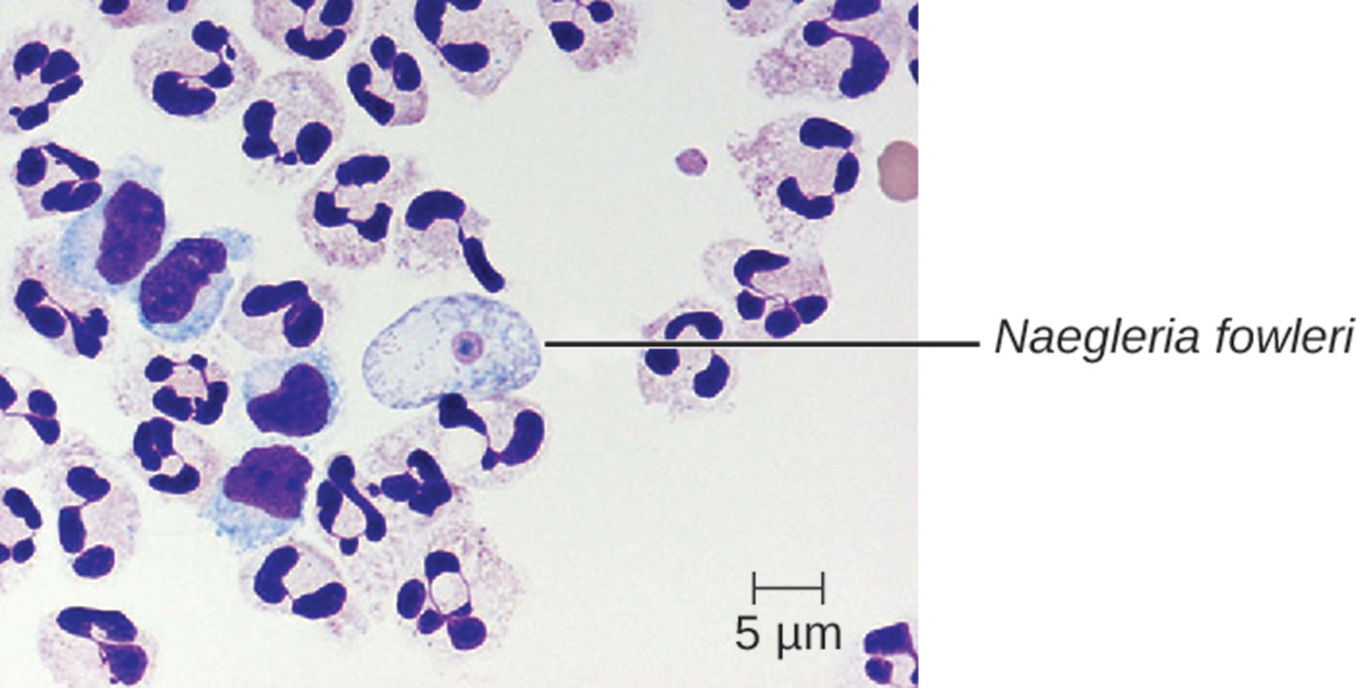 Micrograph of white blood cells and a large cell with a small circle in the center labeled Naegleria fowlerii.