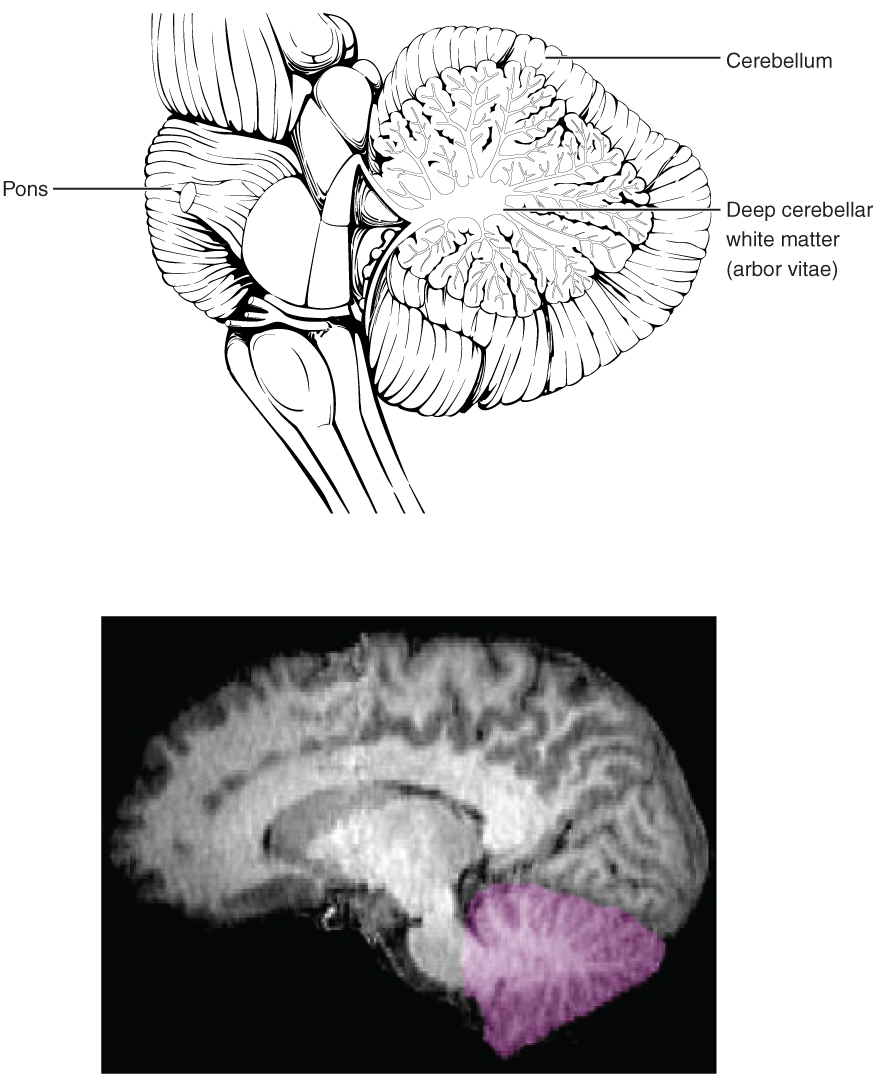 This figure shows the location of the cerebellum in the brain. In the top panel, a lateral view labels the location of the cerebellum and the deep cerebellar white matter. In the bottom panel, a photograph of a brain, with the cerebellum in pink is shown.