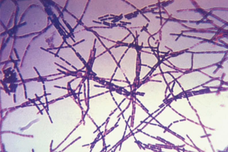 Basic stains stain negatively charged molecules and structures, such as nucleic acids and proteins. The outcome of this positive stain is dark cells on a light background.