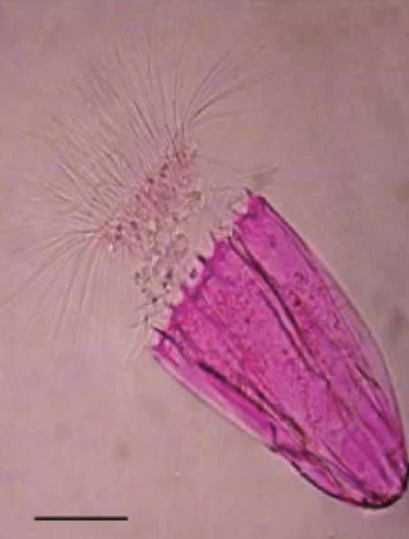 Acid stains stain positively charged molecules and structures such as proteins. Acidic stains can either be positive or negative stains depending on the cell’s chemistry.