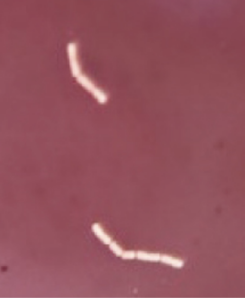 Negative stains include India ink and nigrosin. Negative stains stain the background, not the specimen and produce a dark background with a light specimen.