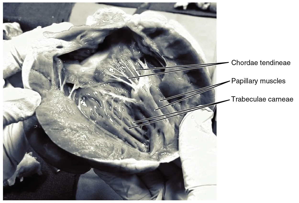 This photo shows the inside of the heart with the main muscles labeled.