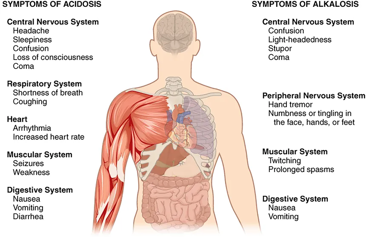 This figure points out the symptoms of acidosis and alkalosis on a silhouette of a human torso. The effects of acidosis on the central nervous system include headache, sleepiness, confusion, loss of consciousness, and coma. The effects of acidosis are given on the left side of the diagram. The effects of acidosis on the respiratory system include shortness of breath and coughing. The effects of acidosis on the heart include arrhythmia and increased heart rate. The effects of acidosis on the muscular system include seizures and weakness. The effects of acidosis on the digestive system include nausea, vomiting, and diarrhea. The right side of the diagram describes the symptoms of alkalosis. The effects of alkalosis on the central nervous system include confusion, light-headedness, stupor, and coma. The effects of alkalosis on the peripheral nervous system include hand tremors and numbness or tingling in the face, hands, and feet. The effects of alkalosis on the muscular system include twitching and prolonged spasms.  The effects of alkalosis on the digestive system include nausea and vomiting.