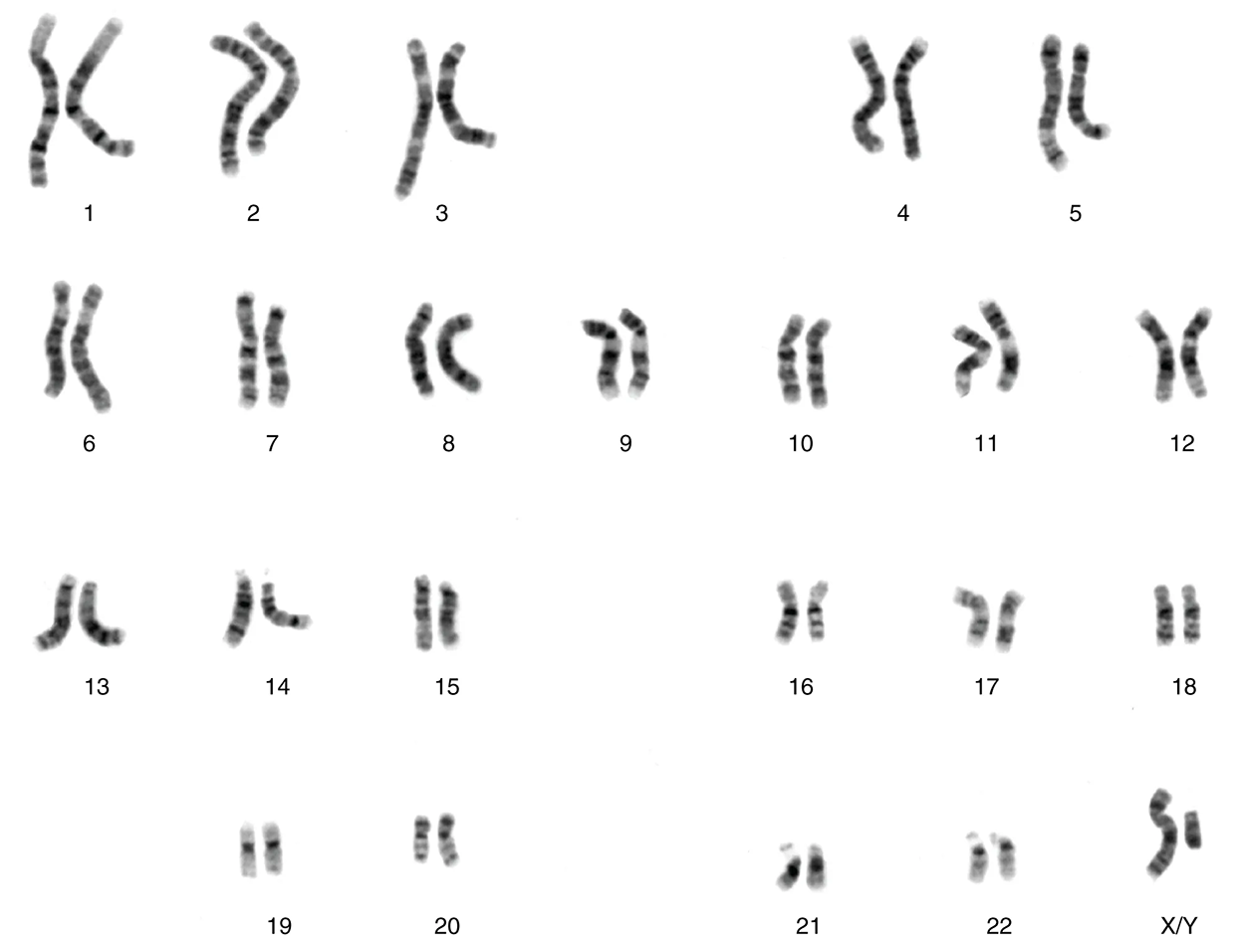 This figure shows the 23 pairs of chromosomes in a male human being.