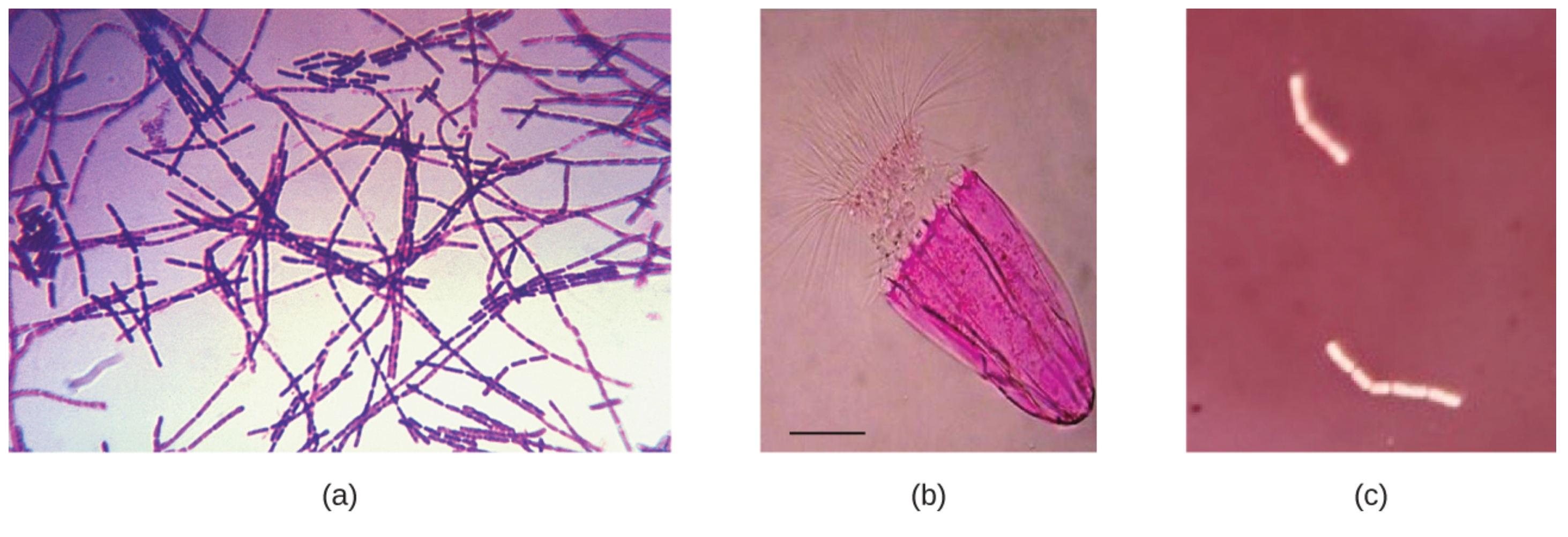 Micrograph A shows many chains of thin purple rods. Micrograph B shows a bright pink half-oval with a tufted top. Micrograph C shows two short, white, unstained chains of rods against a darker background.