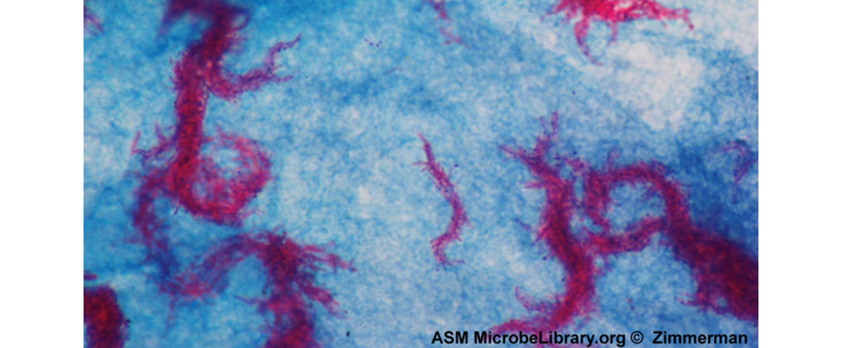 A micrograph shows curved red clumps of rods with thready chains of rods branching outward. The background is stained a patchy light blue color.